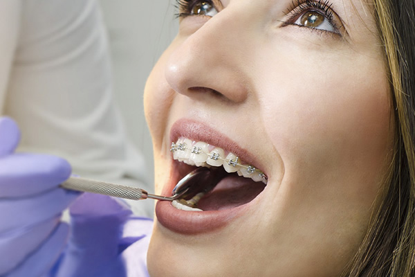 Benefits of Holistic Dentistry